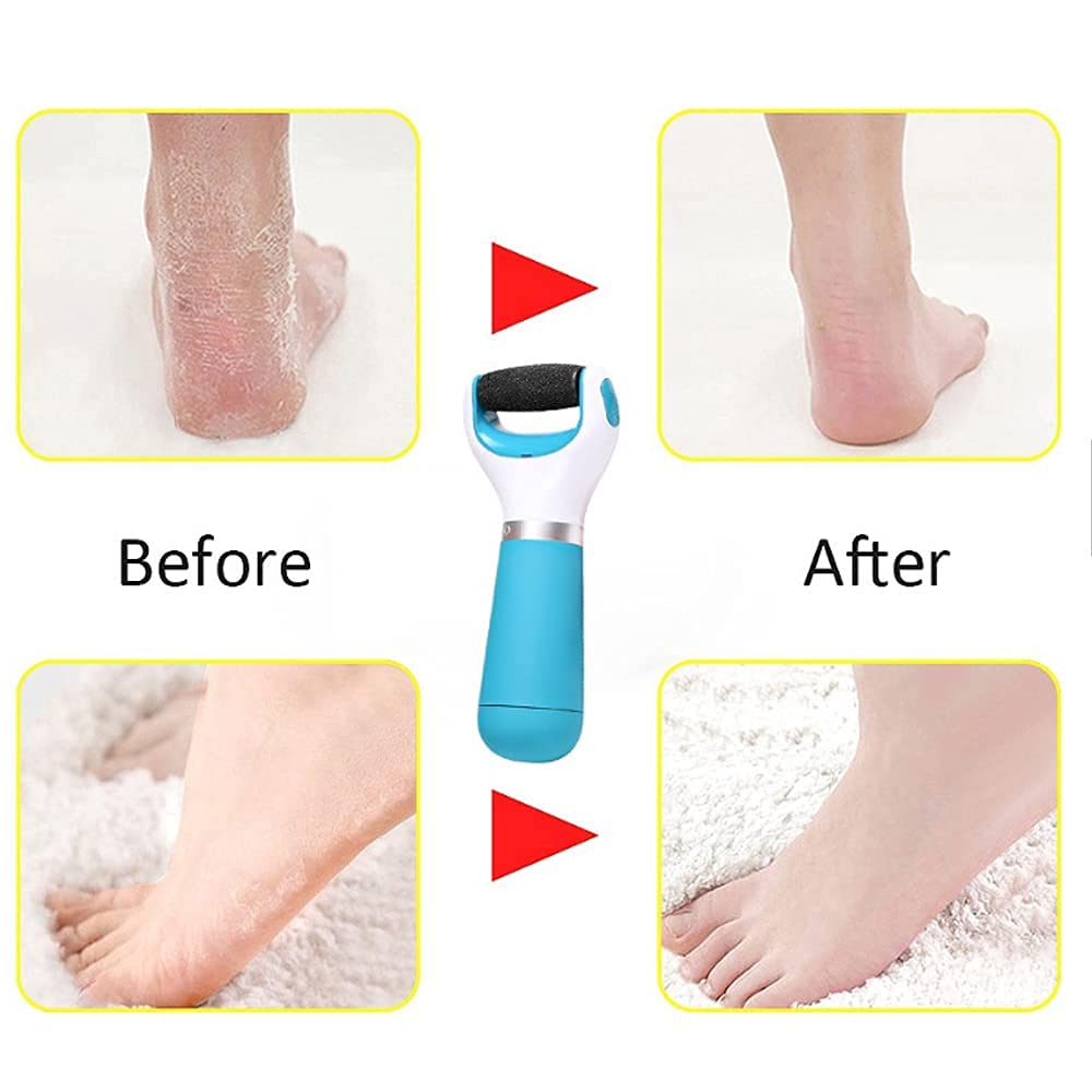 Easy Home Pedicure Roller